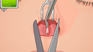 OPERATE NOW : NOSE SURGERY | Educational Body Surgery Games for Kids