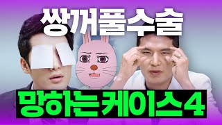 쌍꺼풀수술 재수술이 많은 이유? 😭 안검하수? 함몰눈? 쌍수 망하는 케이스 4가지 | 라라성형외과