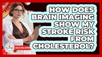 How Does Brain Imaging Show My Stroke Risk From Cholesterol? - Cholesterol Support Network