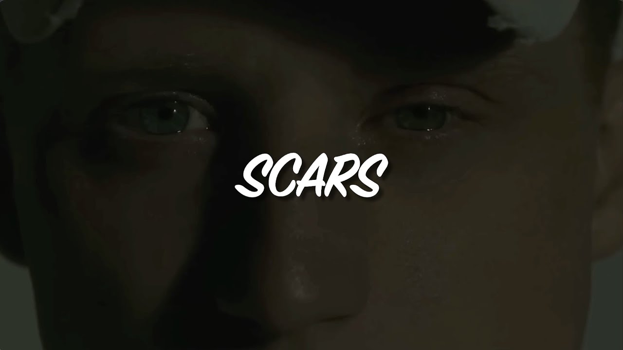 [FREE] Emotional NF Type Beat - SCARS | Sad Rap Instrumental - YouTube