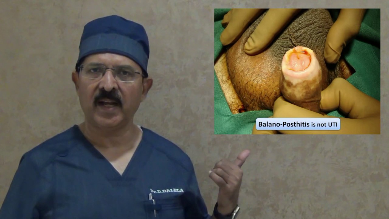 Why & How infection occurs in female urethra 