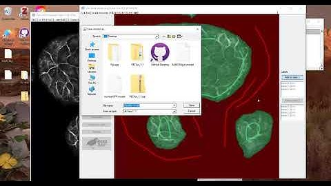 Tutorial 5   Seeded region growing