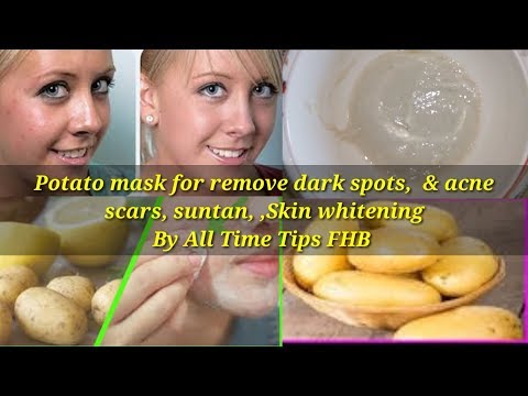 potato-mask-for-remove-dark-spots,-acne-scars,-,skin-whitening-easy-remedy-by-all-time-tips-fhb