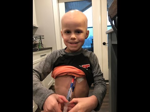Dylan&rsquo;s Battle with Burkitt&rsquo;s Lymphoma