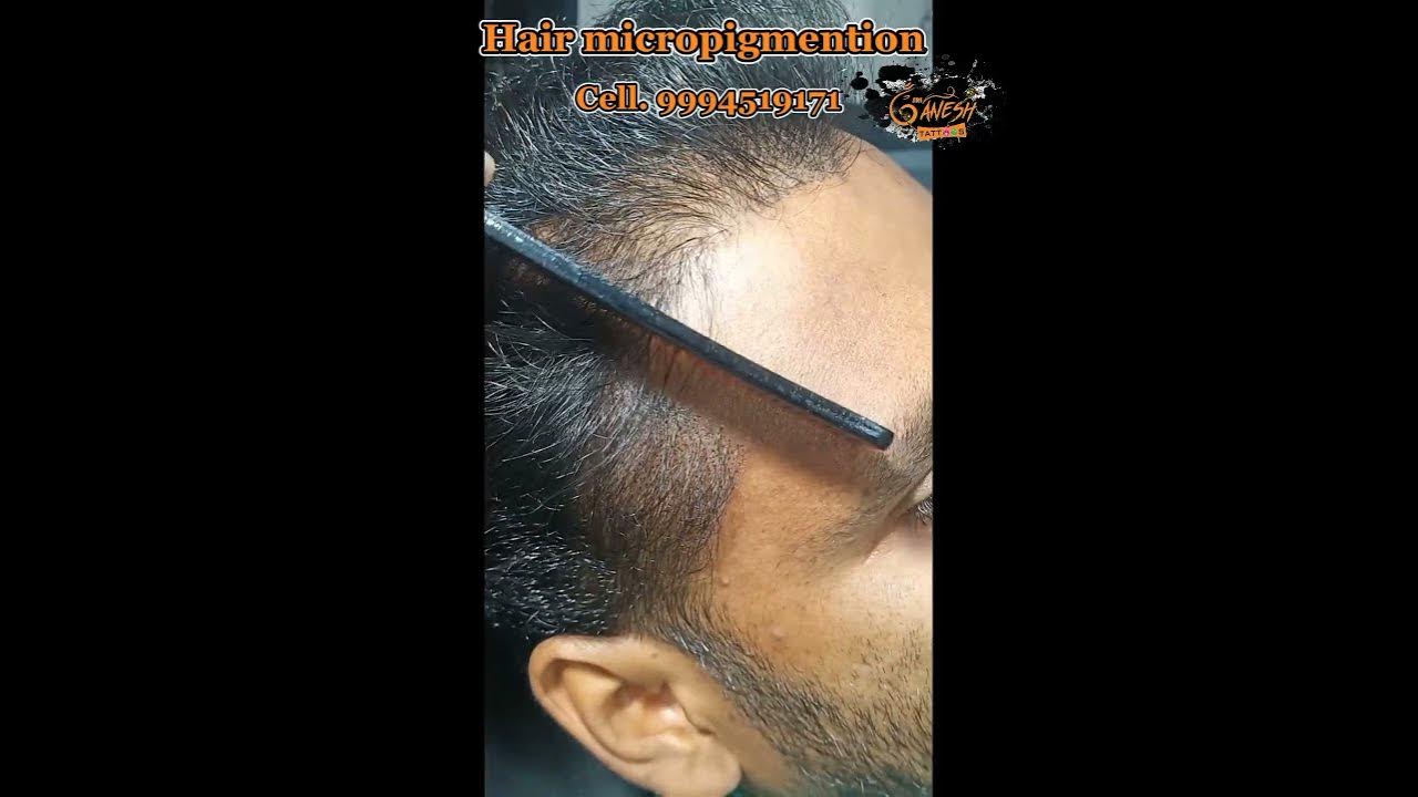 Scalp micropigmentation before after scalp micropigmentation near me