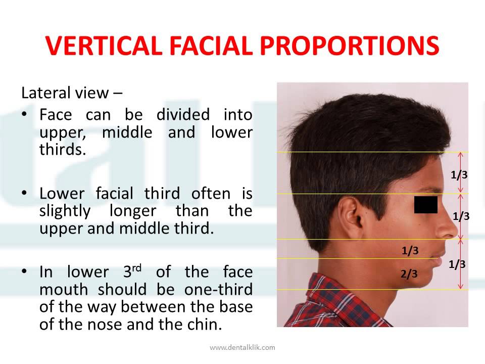Facial Profiles 95