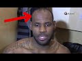 NBA Players that are BALDING