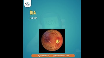 Diabetes Sees What You Don’t. Protect Your Vision | ADEA Eye Care