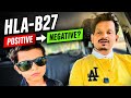 🔴 HLA-B27 Positive को Negative करना Possible है? सच्चाई जानिए #ankylosingspondylitis 