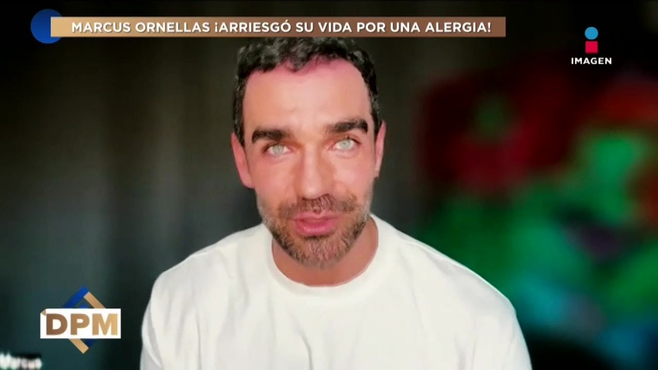 ¡Marcus Ornellas puso en RIESGO su vida al comer CAMARONES siendo alérgico! | De Primera Mano