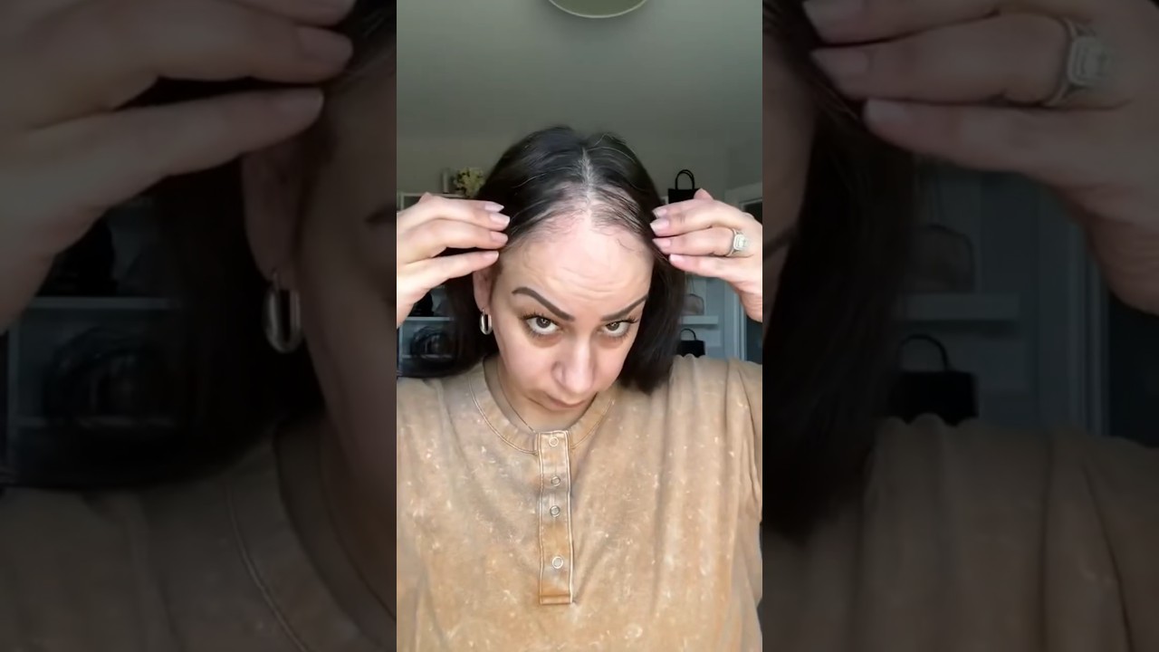 Frontal Hair Loss? This Hairline Topper Changed Everything! | UniWigs Evelyn