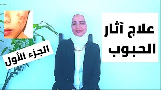 علاج آثار الحبوب