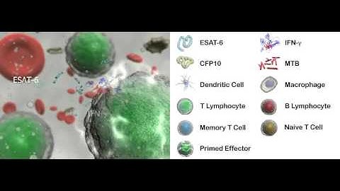 Learning Zone Movie 4 - Latent TB Infection