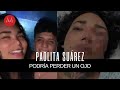 Paola Suárez podría perder ojo tras recibir fuerte golpiza