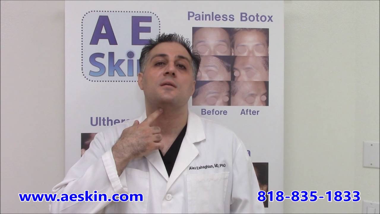 Botox for Neck Bands - A E Skin - Encino, CA - 818-835-1833