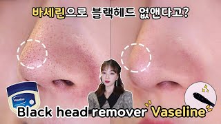 Is it possible to get rid of blackheads with Vaseline? nose blackhead, removing sebum