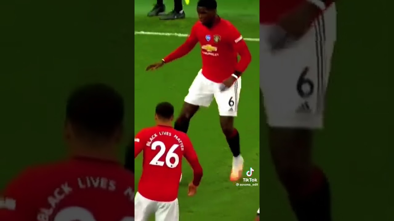 Pogba sikkis