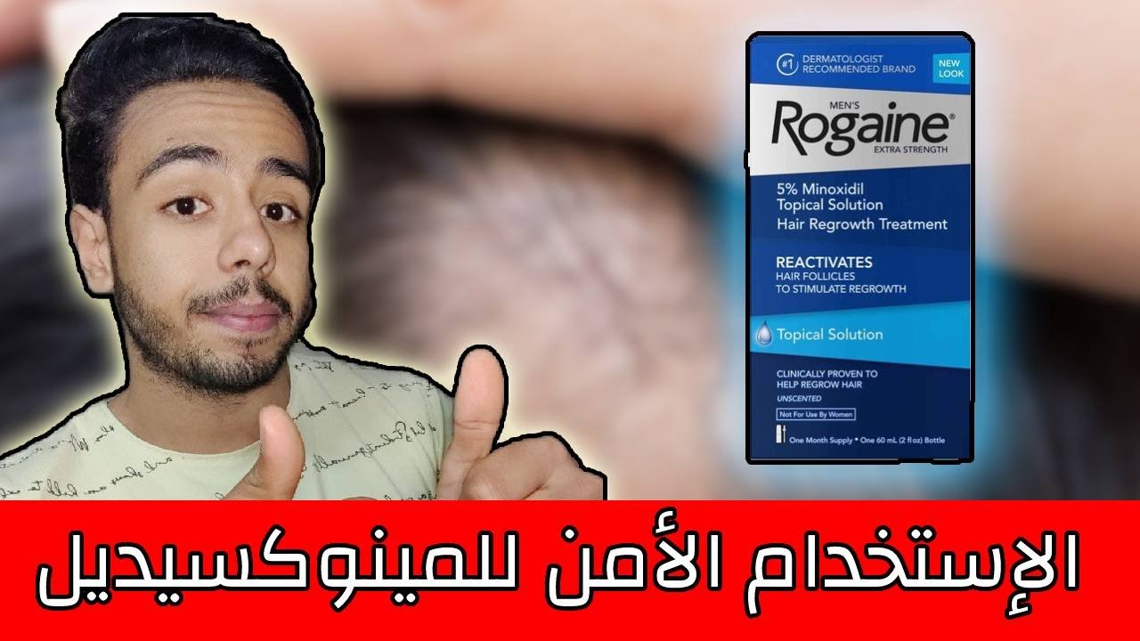 الإستخدام الصحيح للمينوكسيديل
