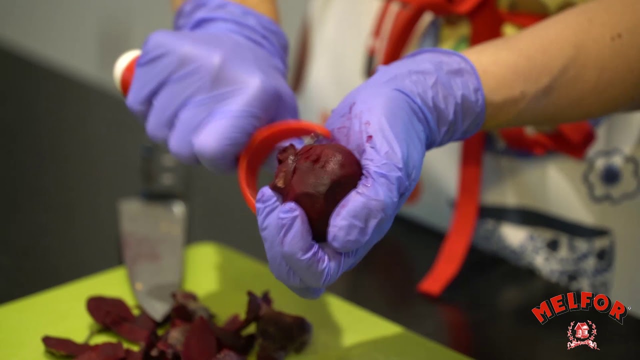 automobile insurance Melfor Herbstsalat mir Ofengemüse kurzversion