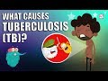 Tuberculosis  what is tuberculosis  tb  tuberculosis disease  the dr binocs show  peekaboo kidz