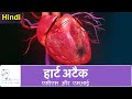 हृदय स्वास्थ्य और कोरोनरी सिंड्रोम