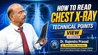How to Read Chest X Ray | Technical Points | View | Prof. (Dr.) Rajendra Prasad