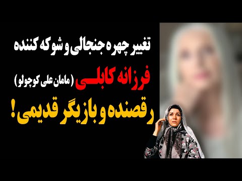 تغییر چهره جنجالی و شوکه کننده فرزانه کابلی مامان علی کوچولو رقصنده و بازیگر قدیمی