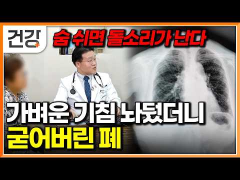 "I’ve never even smoked": The worst habits threatening your lung health | A doctor's guide to hea...