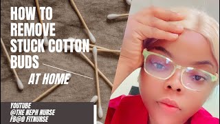 Easy way  to remove stuck cotton buds /in the ear at home