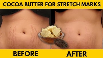 How to Use Cocoa Butter for Stretch Marks - Remove Stretch Marks Naturally