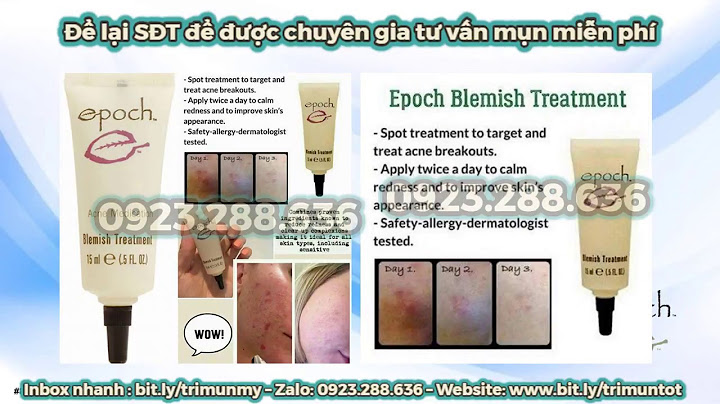 Kem trị thâm smoothe mua ở đâu