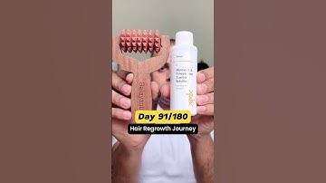 Day 91/180  Traya Minoxidil | Waidon Balayantra | Hair Regrowth