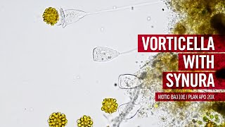 Vorticella plays ball | by Motic Europe