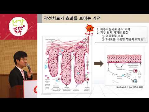 [건강똑똑 건선편 광주] 강의5. 광선치료