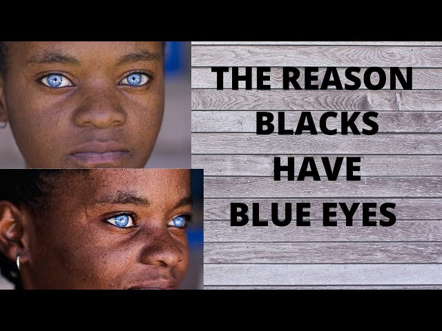 I am an African-American. Why do I have blue eyes? - The Tech