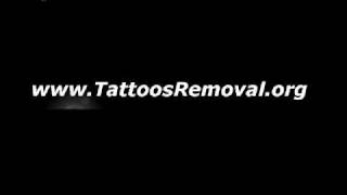 Famous 50 Cent Tattoo Removal Wealth