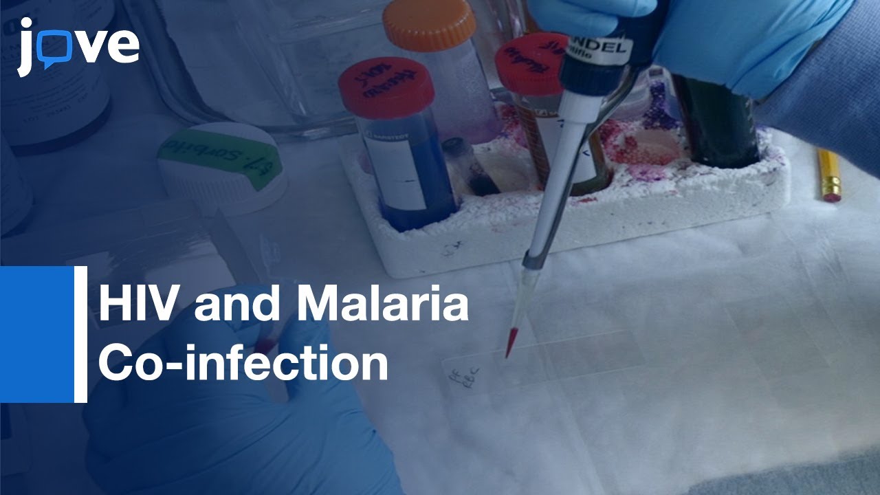 HIV and Malaria Co-infection Model to Study Immune Responses | Protocol ...