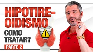 HIPOTIREOIDISMO: o que é? Como tratar? - PARTE 2