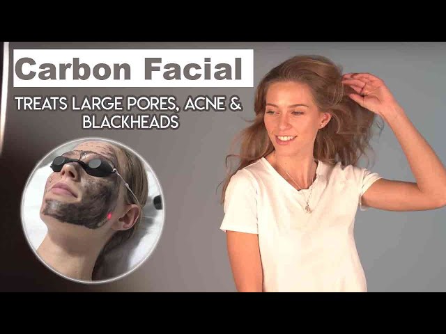 CHARCOAL LASER FACIAL TREATMENT | How it works? | AW3™