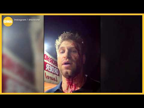 'Pretty Little Liars' actor beaten and robbed in West Hollywood