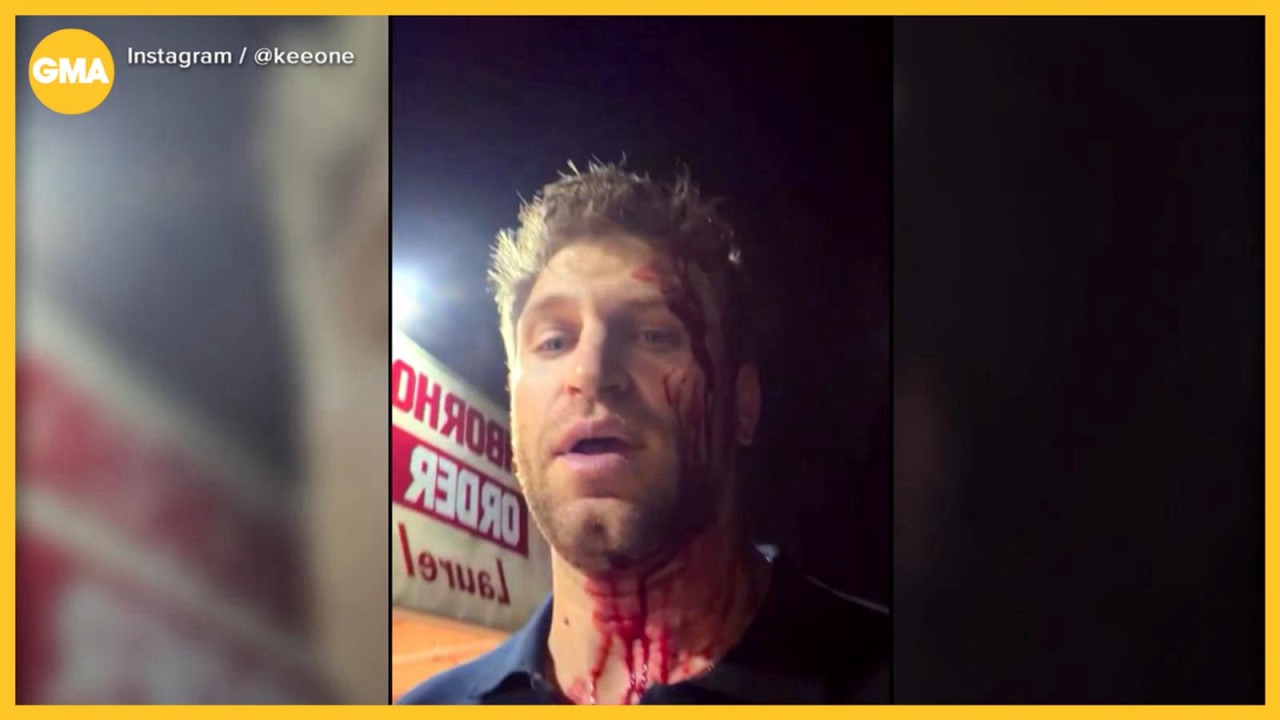 'Pretty Little Liars' actor beaten and robbed in West Hollywood