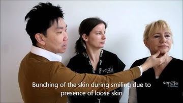 Dr Kieren Bong explains the use of Botox for crow