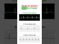 10 must know ECG rhythms 🫀💓 #ecg #ecginterpretation #ekg #electrocardiogram #cardiology