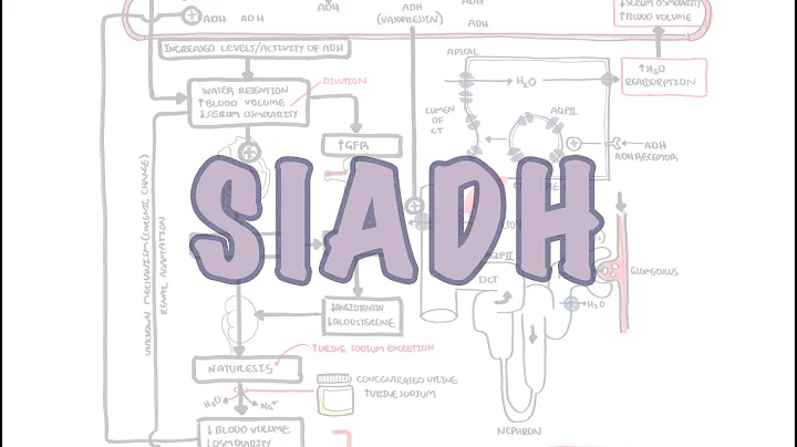 SIADH (Syndrome of Inappropriate ADH secretion) - mechanism, pathophysiology, treatment