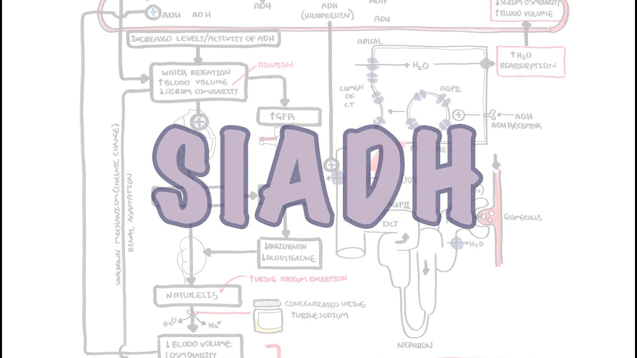 SIADH (Syndrome of Inappropriate ADH secretion) – mechanism, pathophysiology, treatment | ข้อมูลรายละเอียดมากที่สุดเกี่ยวกับadh คือ