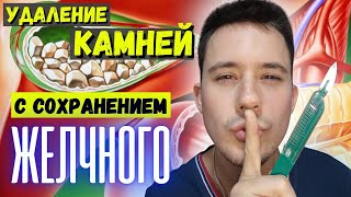 Желчекаменная болезнь. Холецистэктомия необязательна???