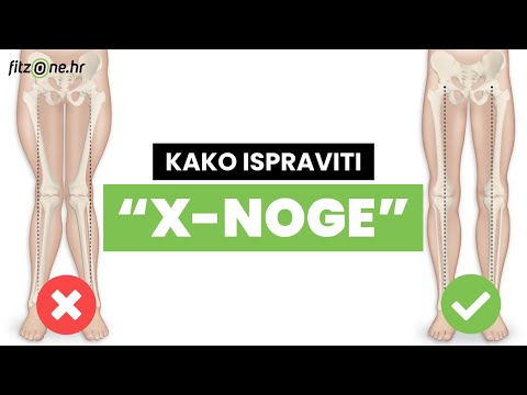 Video: Kako Izravnati Noge