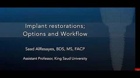 Implant Restorations ; Options and Workflow by Dr Saad AlResayes