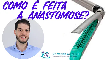 Qual o tamanho ideal da anastomose?