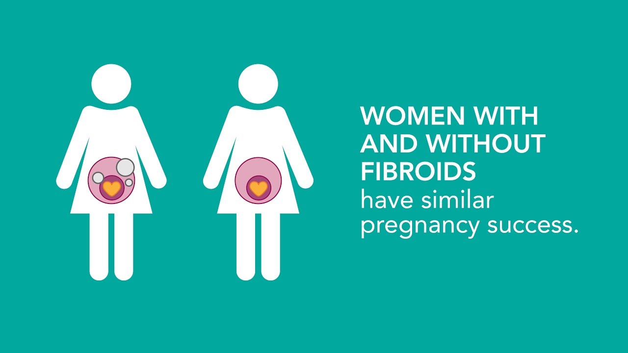 Uterine Fibroids and Chance of Miscarriage - YouTube